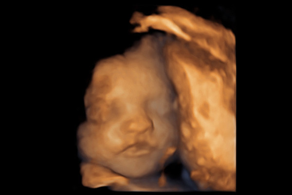 4D Baby Scans at Hello Baby