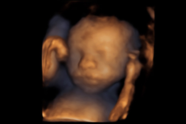 4D Baby Scans at Hello Baby