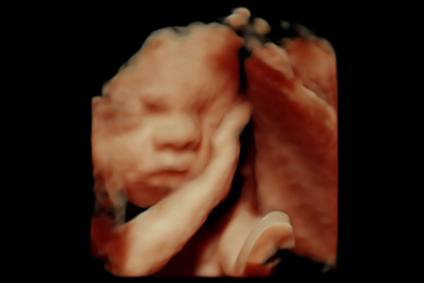HD-Live Baby Scans St Helens