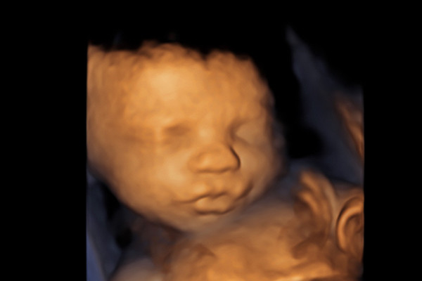 4D Baby Scans - Hello Baby
