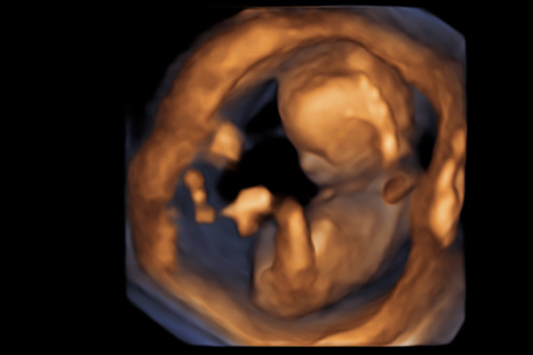 4D Ultrasound Baby Scan - Hello Baby
