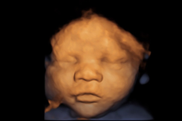Future Baby 4D Scanning