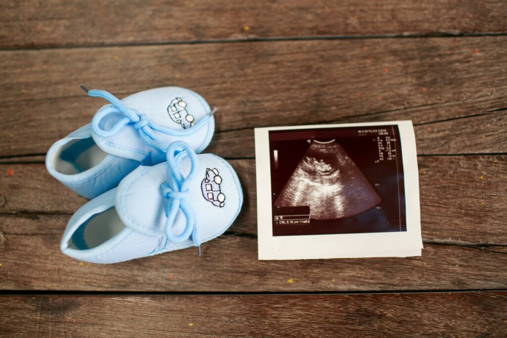 Gender Scans - Early Gender Scans St Helens - Hello Baby